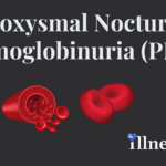 Paroxysmal Nocturnal Hemoglobinuria (PNH)