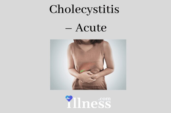 Cholecystitis – Acute