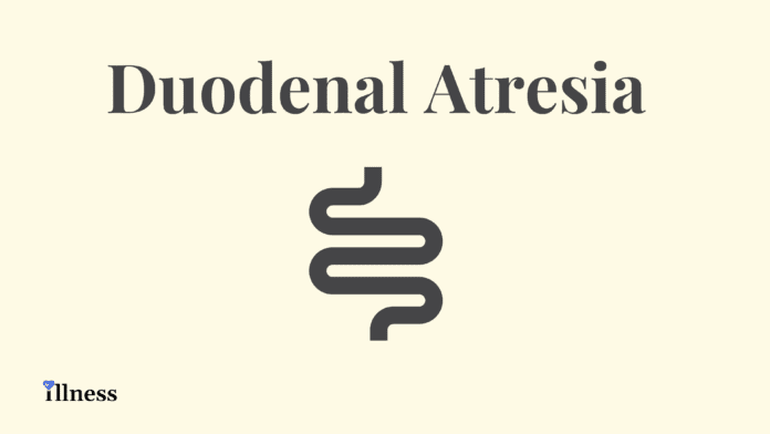 Duodenal Atresia