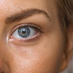 The Gut-Skin Connection & How To Improve It: A Naturopathic Perspective