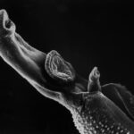 Can Parasites Live In Your System? Here’s How To Get Rid Of Them